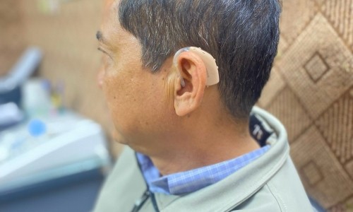 Máy trợ thính công suất lớn dành cho người nghe kém mức độ nặng-sâu. 