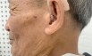 Máy trợ thính ngoắc sau vành tai BTE